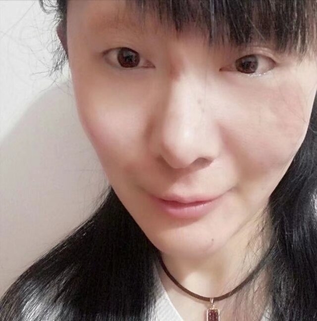 徐颖的第三张照片--山东残疾人相亲网